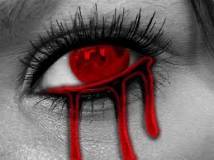 bleeding eye